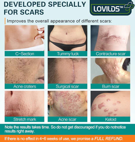 LOVILDS™ SilkRenew Scar Recovery Spray