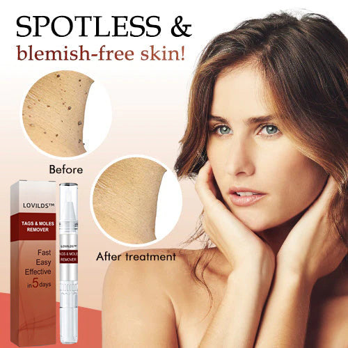 🎁Official Factory Direct Sales🎁Tags & Moles Remover