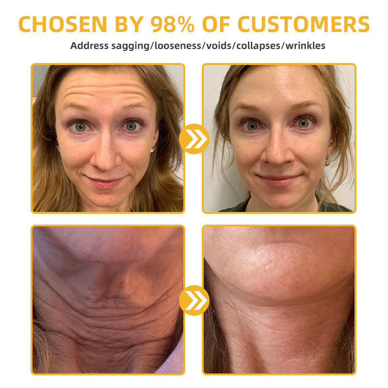 🌱🐝LOVILDS™ BeeAura Anti-Aging Firming Cream,Address Crepe & Sagging(🔥70% Off for a Limited Time!)