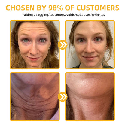 🌱🐝LOVILDS™ BeeAura Anti-Aging Firming Cream,Address Crepe & Sagging(🔥70% Off for a Limited Time!)