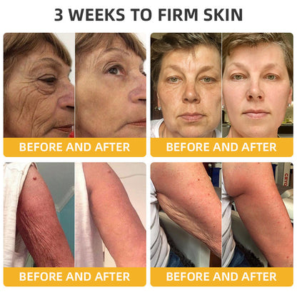 🌱🐝LOVILDS™ BeeAura Anti-Aging Firming Cream,Address Crepe & Sagging(🔥70% Off for a Limited Time!)