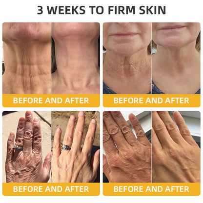 🌱🐝LOVILDS™ BeeAura Anti-Aging Firming Cream,Address Crepe & Sagging(🔥70% Off for a Limited Time!)
