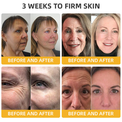 🌱🐝LOVILDS™ BeeAura Anti-Aging Firming Cream,Address Crepe & Sagging(🔥70% Off for a Limited Time!)