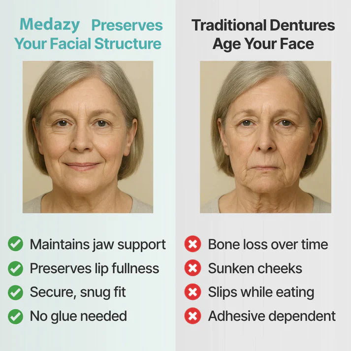 Medazy™ Custom-Fit Full Functional Dentures