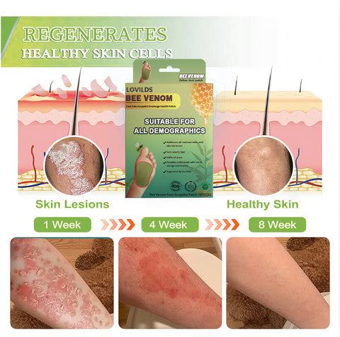 LOVILDS™ LymphTox Bee Venom Slimming & Detox Foot Patches