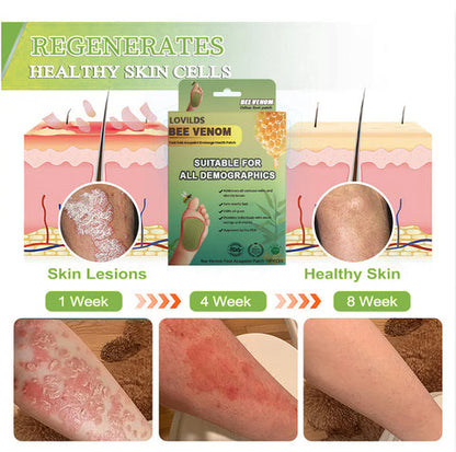 LOVILDS™ LymphTox Bee Venom Slimming & Detox Foot Patches