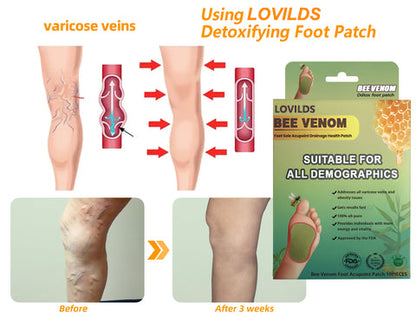 LOVILDS™ LymphTox Bee Venom Slimming & Detox Foot Patches