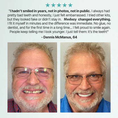 Medazy™ Custom-Fit Full Functional Dentures